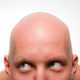 Illustration for article titled The Best Cure For Balding May Be to Pluck Whats Left